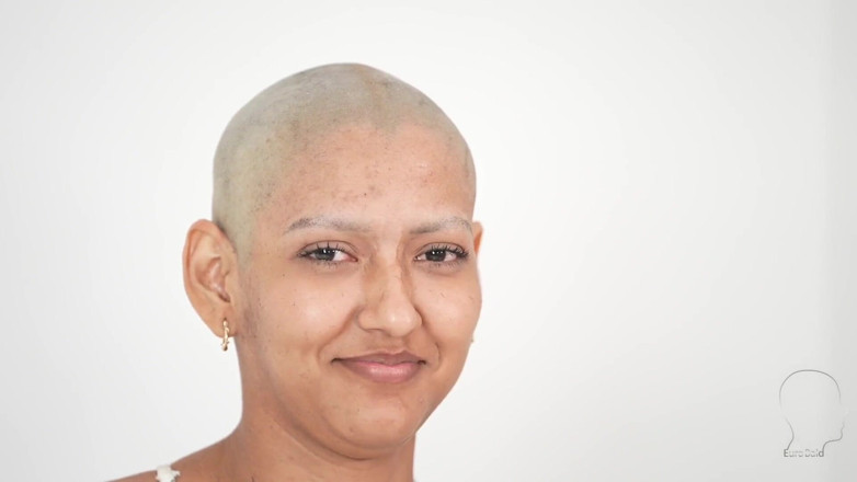 Euro Bald: Hindi