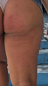 My Ass Outdoor