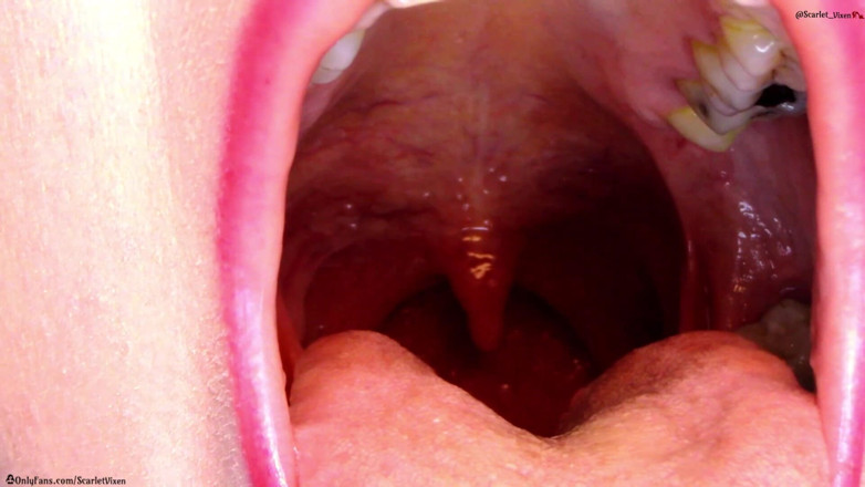 Scarlet Vixen: Keel, uvula en mond pronken