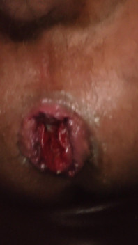 Playing with My Rosebud'd Pig Hole