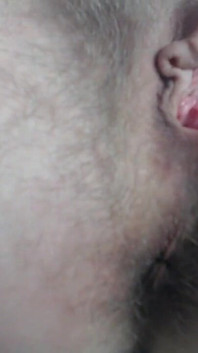 Prolapse Play Close up