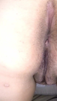 7132787
