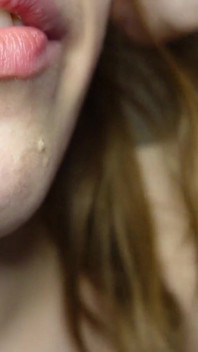 Te Cuento Sobre Los Rellenos En Mis Dientes Y Las Visitas Al Dentista