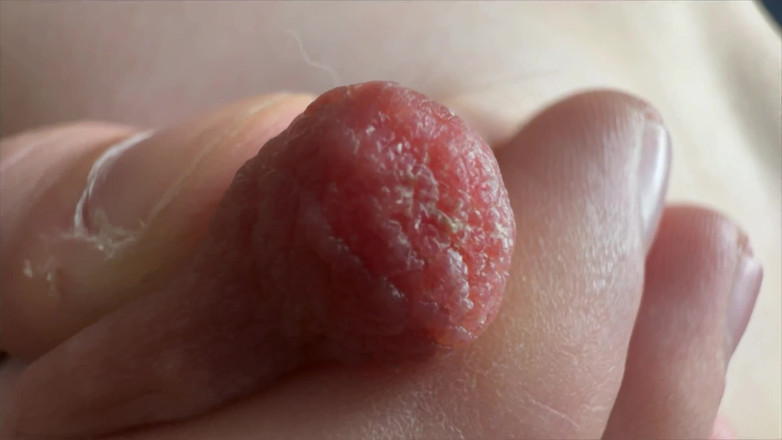 Skinny_lady69: Meme uçları süper yakın çekim