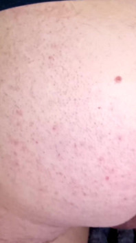 Première sodomie de ma femme. Creampie anal. Lavement. Ch 2. 20421
