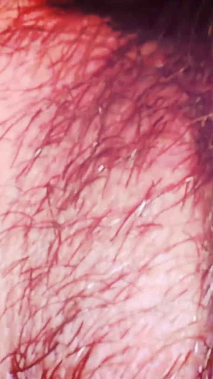 Nicoletta Embassi: เปอร์สเป็คทีฟแบบมาโครโคลสอัพอย่างสุดขีดด้วยกล้องไมโคร