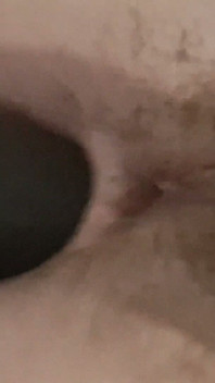Dylatacja