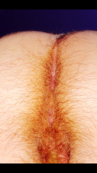 Hairy Butt of a 5-month Pregnant Woman