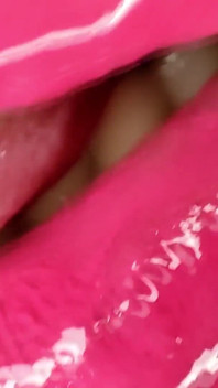 Permanent Retainers Mouth Tour