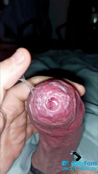 Cum Play with Phimosis Tight Foreskin