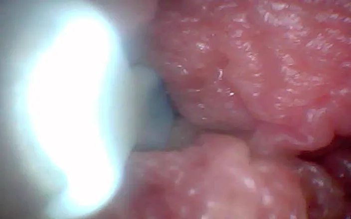 Twittiy: Endoscope Camera Shows the Most Sensitive Parts of the Penis...