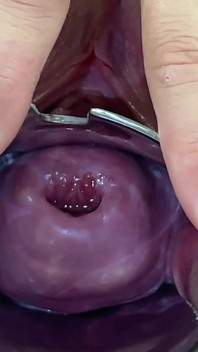 Glass Dildo Cervix Penetration