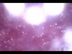 Lina Free: Nafukování močového měchýře vzduchem!