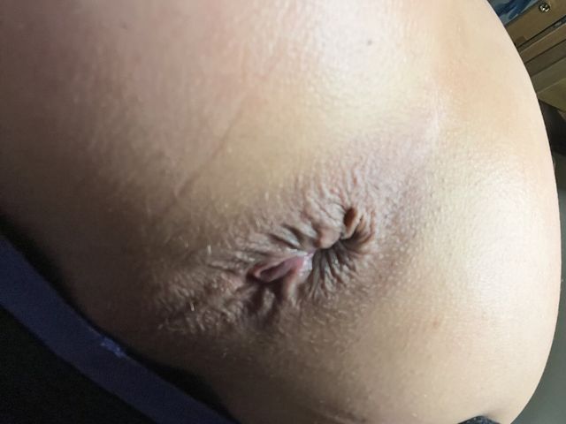 Staceylovesanal Vibrator Ass Cum Self Fuck (Stacey Loves Anal xxx)