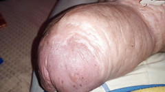 Monster_Meat_: 2liter glukozy "w połowie" mojego podwójnego wstrzyknięcia