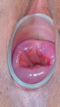 I Fuck My Cervix with a Blue Dildo with 3.5 and 4.5 Cm Basin.
