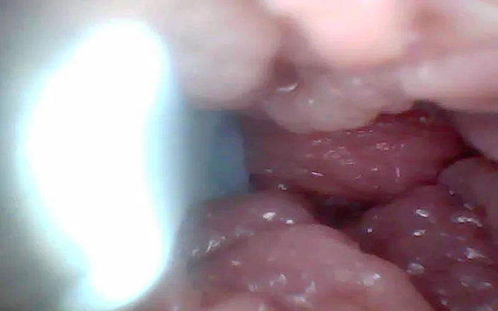 Twittiy: Endoscope Camera Shows the Most Sensitive Parts of the Penis...