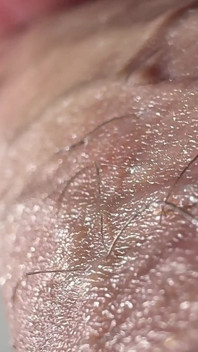 Penis Tropft