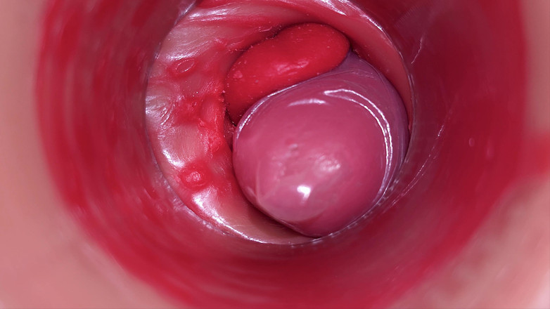 Creme sperm: Bên trong camera pov cổ tử cung camgirl trong âm đạo với đồ...