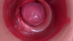 Creme sperm: Innerhalb einer camgirl Gebärmutterhals POV-Kamera in der vagina mit großem...
