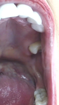 Всередині мого великого рота язиком зуби uvula