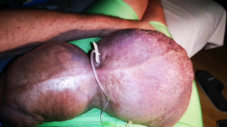 Monster_Meat_: Glukosa Liter ke-3