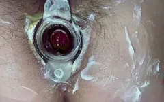 Hot Anal gaping & tunnel plug. Hairy cunt & asshole close-up
