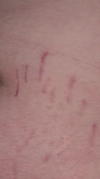 Knulla och spruta in i hennes navel navel