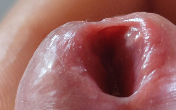 Straight Daddy Club: Opening the Scar of the Rough Frenulum!