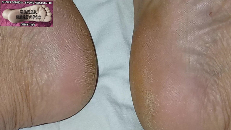 Casal Gresopio Male: Gresopio in Male Feet 16