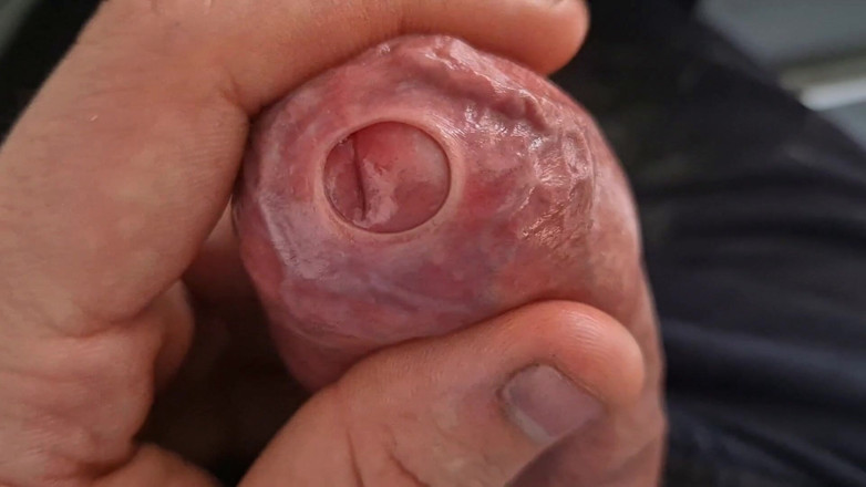 GloomyChase977: Se lo accarezza con il prepuzio stretto fino a quando...