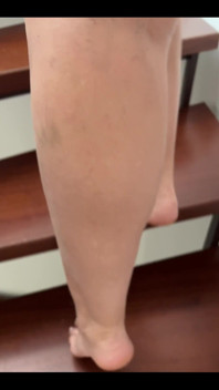 First Time White Toenails in My Life