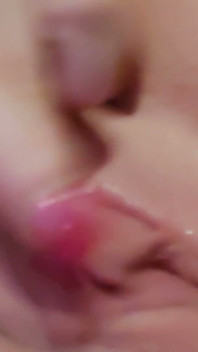 ช่องคลอดรั่วทั้งสองรู