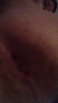 Pulse Ass