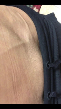 Someone Special Requested My Veins