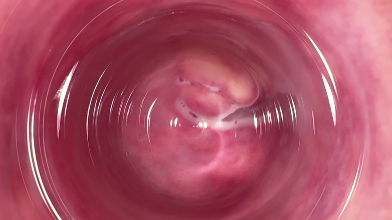 Kinky Mia: Adik tiriku nunjukin apa yang ada di dalam memeknya yang...