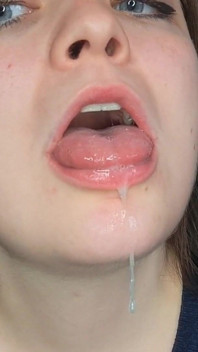 Alison's Mouth Inspection and Spit Play