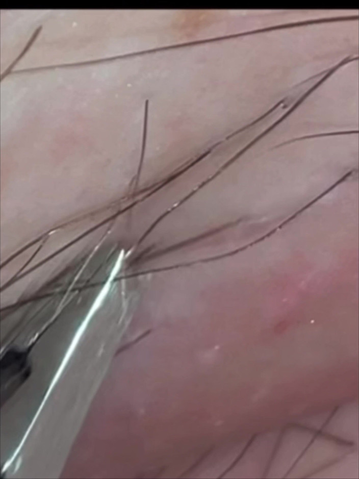 SatisfyingDillyDally: Hints naar gedetailleerde soepelheid