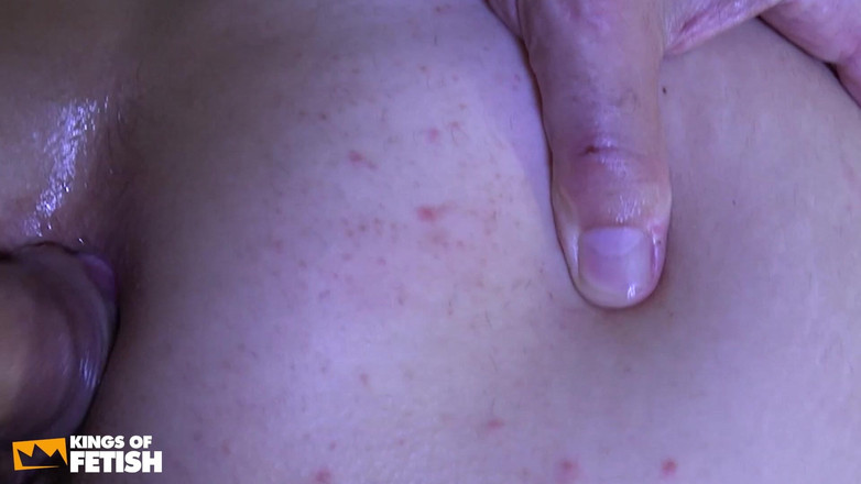 Fixed on Mature: Brunetka pacientka chčije po hlubokém análním šukání od svého staršího lékaře