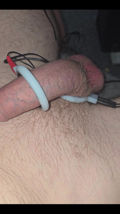 The Max Powers: Электро-шок члена