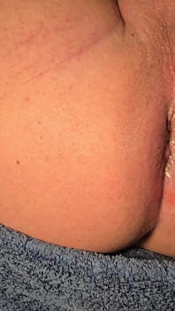 Brazilian Wax Asshole