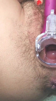 Orgasm în prim-plan în timpul pizdei deschise folosind un speculum