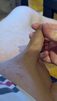 It Is Played with My Little Cock and the Long Foreskin and Sucked on. Part 4