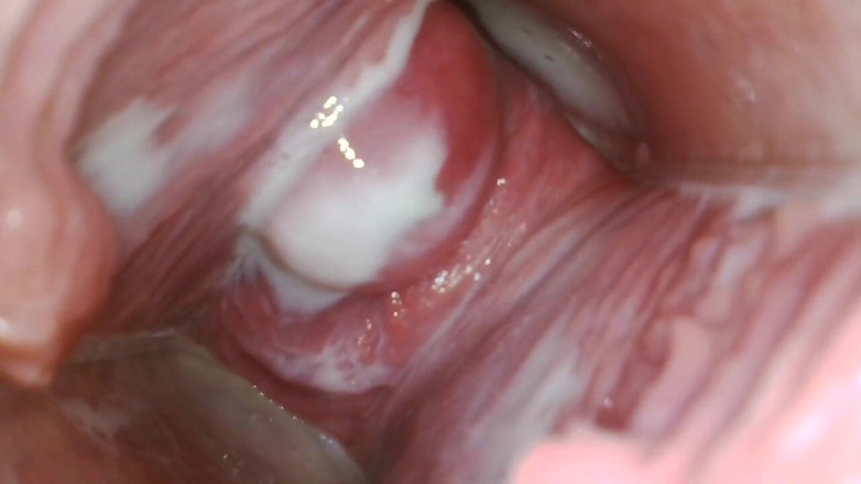 JANA studios: Endoscopio nella mia figa