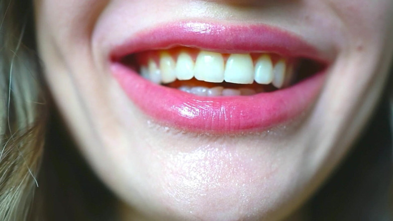 Rarible Diamond: Un succoso bacio nudo