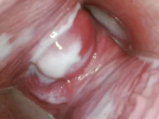 Endoscope dans ma chatte