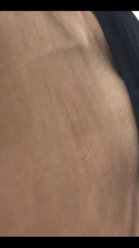 Someone Special Requested My Veins