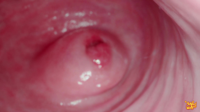 MollyRedWolf: Hey Stepbrother! Let's Play Gynecologist? Gyno, Endoscopy - Mollyredwolf