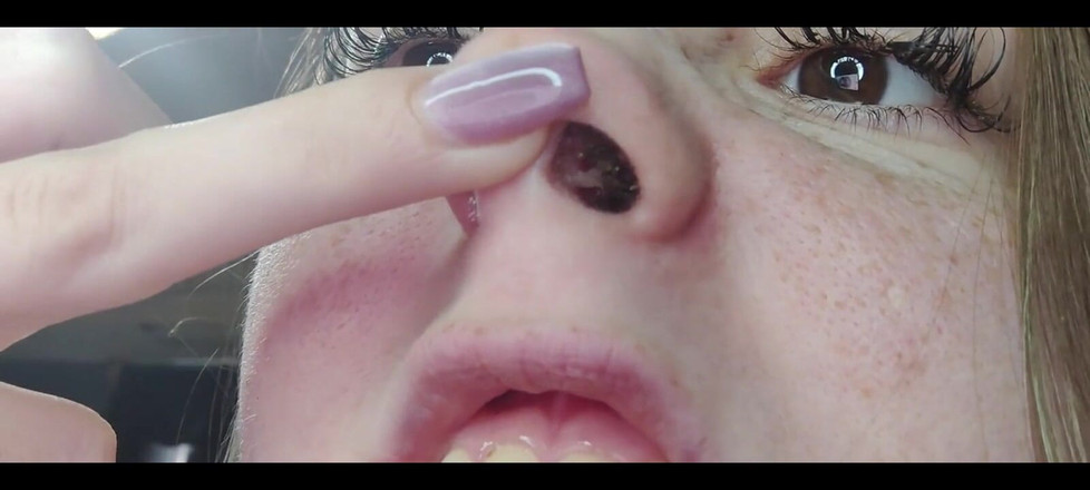 RavenHearth666VIP: Runny Nose Close up