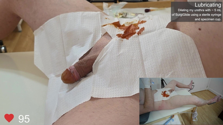 Clinical Climax: Kathetereinschub